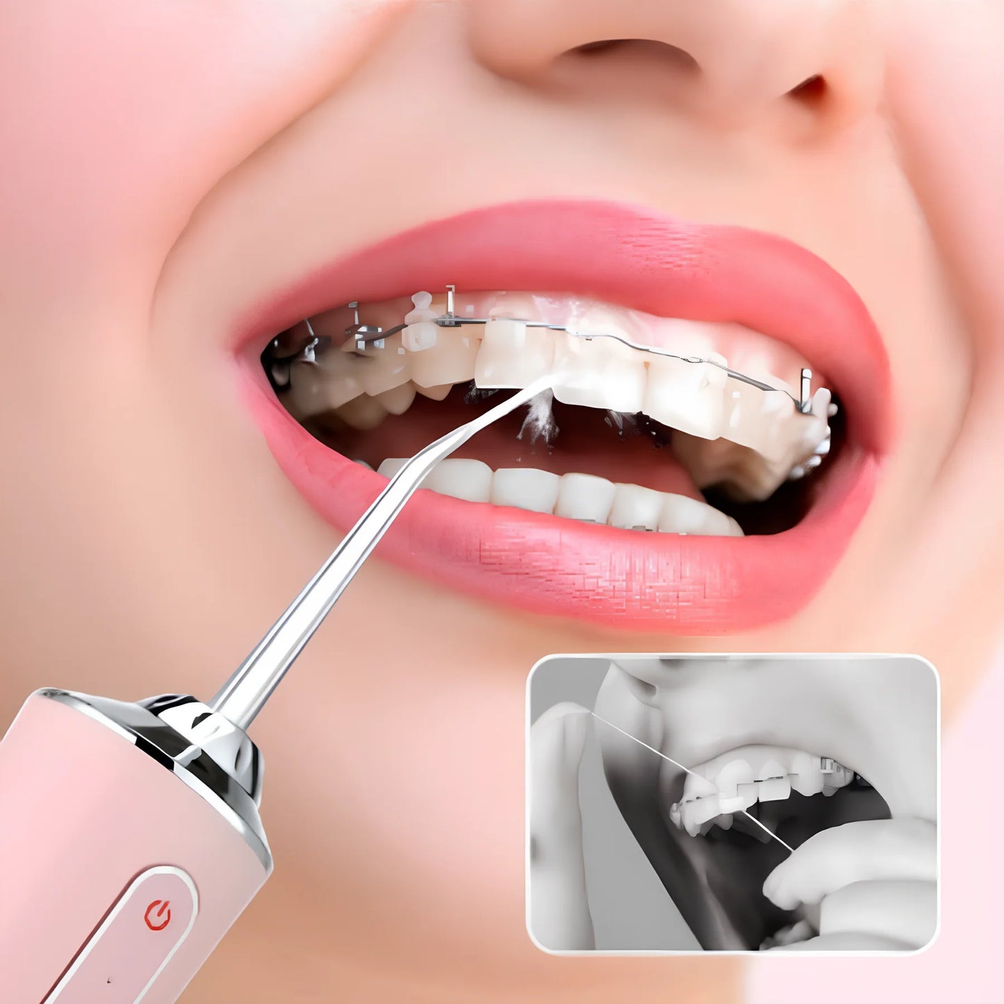 Irrigador Portátil 4 En 1 HidroDent™| Sonrisa Perfecta